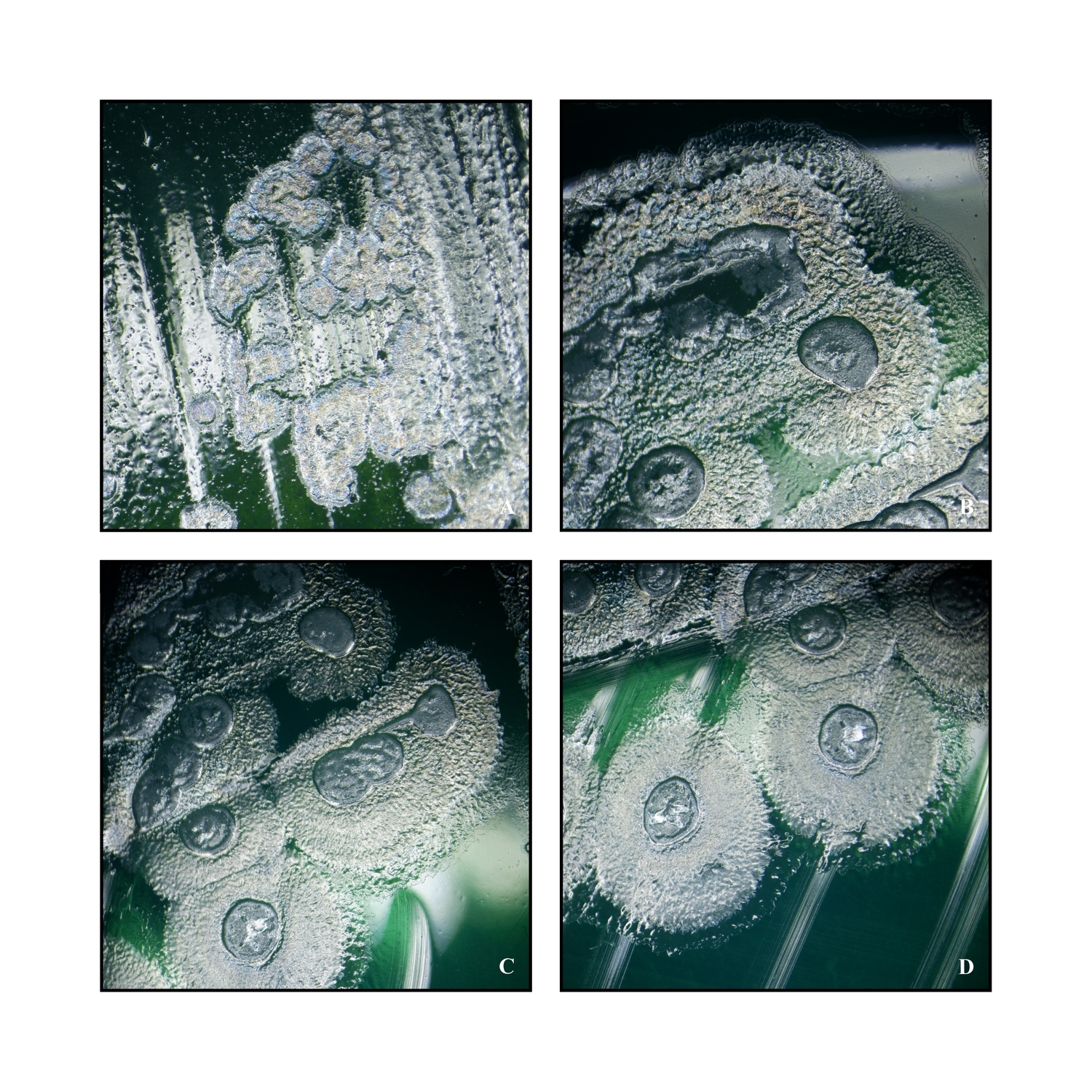 Pseudomonas aeruginosa Pseudomonas aeruginosa